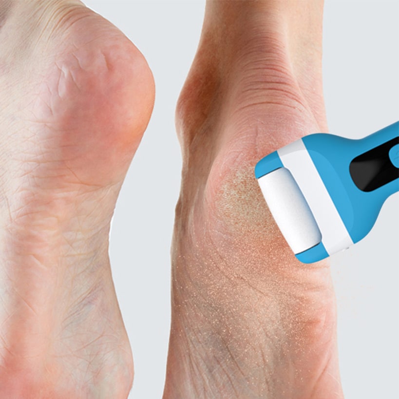 Prospera Electric Foot Smoother With 3 Roller Heads