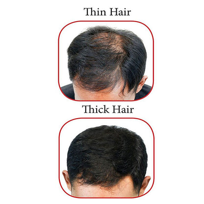 Light and Massage Therapy Hair Brush