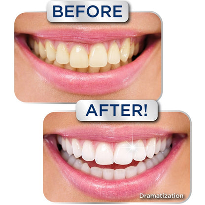 Miracle Smile® Teeth Whitening Gel - 2 Shades Whiter in 2 Minutes