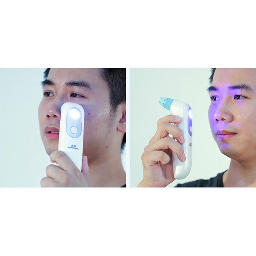 Prospera Blackhead Remover